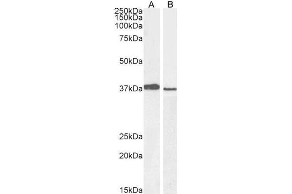 PCGF2 Antikörper  (C-Term)