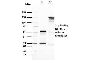 SDS-PAGE Analysis Purified Nestin Mouse Monoclonal Antibody (NES/2911). (Nestin antibody  (AA 698-844))