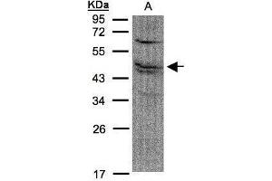 WB Image Sample(30 μg of whole cell lysate) A:A431, 12% SDS PAGE antibody diluted at 1:1500 (FDFT1 antibody)