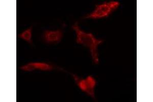 ABIN6274274 staining HuvEc cells by IF/ICC. (GALK1 antibody  (C-Term))