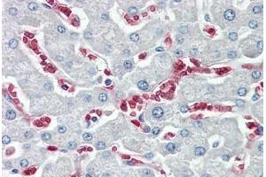 Image no. 2 for anti-Lysyl-tRNA Synthetase (KARS) (C-Term) antibody (ABIN6749717) (KARS antibody  (C-Term))