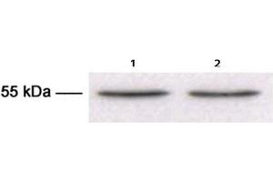 Western Blotting (WB) image for anti-Tubulin, beta 3 (TUBB3) antibody (ABIN1109374) (TUBB3 antibody)