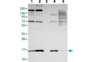 Western blot analysis of Lane 1: RT-4, Lane 2: U-251 MG, Lane 3: Human Plasma, Lane 4: Liver, Lane 5: Tonsil with COX20 polyclonal antibody  at 1:250-1:500 dilution.