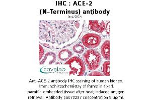 Image no. 1 for anti-Angiotensin I Converting Enzyme 2 (ACE2) antibody (ABIN1731444) (ACE2 antibody)