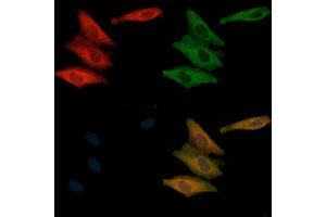 ABIN6265950 and ABIN6269155 staining  cells(H2O2 treatment) by IF/ICC. (VAV1 antibody  (N-Term))
