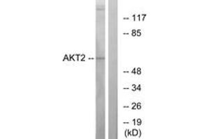 Western blot analysis of extracts from A2780 cells, treated with TNF-alpha, using Akt2 (Ab-474) Antibody. (AKT2 antibody  (AA 432-481))