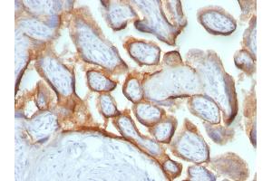 Formalin-fixed, paraffin-embedded human Placenta stained with hCG beta Mouse Monoclonal Antibody (HCGb/54 + HCGb/459). (CGB antibody)