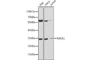Western blot analysis of extracts of various cell lines, using R antibody (ABIN6131708, ABIN6141226, ABIN6141228 and ABIN6217372) at 1:1000 dilution. (GNB2L1 antibody  (AA 30-290))