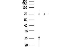 anti-Thyroid Hormone Receptor Interactor 10 (TRIP10) (Internal Region) antibody
