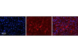 Rabbit Anti-LYPLA2 Antibody  Catalog Number: ARP58638_P050 Formalin Fixed Paraffin Embedded Tissue: Human Adult Liver  Observed Staining: Cytoplasm in hepatocytes, strong signal, low tissue distribution Primary Antibody Concentration: 1:100 Secondary Antibody: Donkey anti-Rabbit-Cy3 Secondary Antibody Concentration: 1:200 Magnification: 20X Exposure Time: 0. (LYPLA2 antibody  (N-Term))