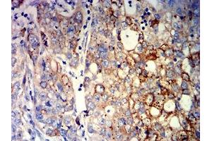 Immunohistochemistry (IHC) image for anti-Cyclin D1 (CCND1) (AA 1-295) antibody (ABIN7193695)