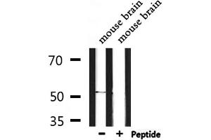 Western blot analysis of extracts from mouse brain, using ETBR2 Antibody. (GPR37L1 antibody  (N-Term))