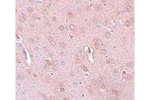 Immunohistochemistry of TRESK in rat brain tissue with this product at 5 μg/ml. (KCNK18 antibody  (Center))