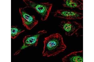 Fluorescent confocal image of HeLa cell stained with TFE3 antibody. (TFE3 antibody  (AA 1-30))