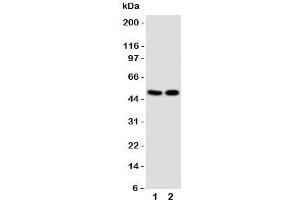 Western blot testing of VDR antibody and Lane 1:  MCF-7;  2: HeLa cell lysate. (Vitamin D Receptor antibody  (C-Term))