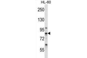 Western Blotting (WB) image for anti-Calpain 6 (CAPN6) antibody (ABIN2996811) (Calpain 6 antibody)