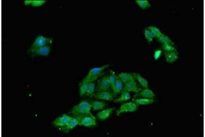 Immunofluorescent analysis of HepG2 cells using ABIN7173917 at dilution of 1:100 and Alexa Fluor 488-congugated AffiniPure Goat Anti-Rabbit IgG(H+L) (TP53INP1 antibody  (AA 138-205))