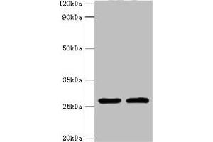 Western blot All lanes: ACRV1 antibody at 4 μg/mL Lane 1: Mouse liver tissue Lane 2: Mouse gonad tissue Secondary Goat polyclonal to rabbit IgG at 1/10000 dilution Predicted band size: 29, 27, 23, 21, 20, 19, 18, 17, 14, 9 kDa Observed band size: 29 kDa (ACRV1 antibody  (AA 22-265))