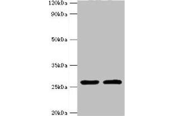 ACRV1 Antikörper  (AA 22-265)