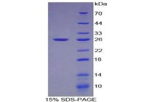 SDS-PAGE (SDS) image for SMAD, Mothers Against DPP Homolog 1 (SMAD1) (AA 270-465) protein (His tag) (ABIN2125952)