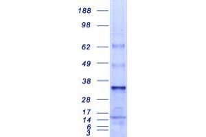 Western Blotting (WB) image for Mediator Complex Subunit 7 (MED7) (Transcript Variant 2) protein (Myc-DYKDDDDK Tag) (ABIN2725751)