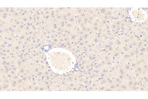 Detection of C1INH in Mouse Liver Tissue using Polyclonal Antibody to Complement 1 Inhibitor (C1INH) (SERPING1 antibody  (AA 211-331))