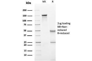 SDS-PAGE Analysis Purified IgG Mouse Recombinant Monoclonal Antibody (rIG266). (Recombinant IGHG antibody)