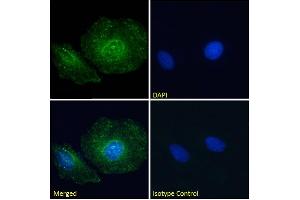 Immunofluorescence staining of fixed HeLa cells with anti-Paxillin (LD4 Motif) antibody LD4 sAB.