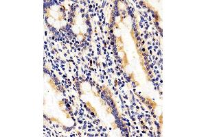 Immunohistochemical analysis of paraffin-embedded H. (RAB35 antibody  (C-Term))