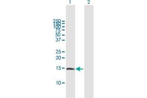 Western Blot analysis of ZNRD1 expression in transfected 293T cell line by ZNRD1 MaxPab polyclonal antibody. (ZNRD1 antibody  (AA 1-126))