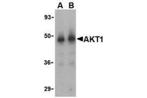 Western blot analysis of Akt1 in human liver cell lysate with AP30042PU-N Akt1 antibody at (A) 1 and (B) 2 μg/ml. (AKT1 antibody)