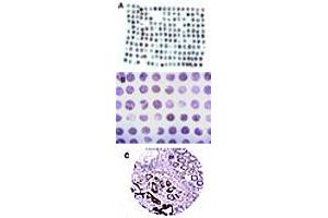 Formalin-fixed, paraffin-embedded tissue human colon microarray stained for CARD8 expression at 1 : 2000. (CARD8 antibody)
