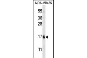 HIST1H2BC/HIST1H2BF Antibody (N-term) (ABIN656773 and ABIN2845992) western blot analysis in MDA-M cell line lysates (35 μg/lane). (HIST1H2BC,HIST1H2BF (AA 1-30), (N-Term) antibody)