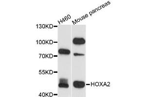 Western blot analysis of extracts of various cell lines, using HOXA2 antibody (ABIN5995946) at 1/1000 dilution. (HOXA2 antibody)