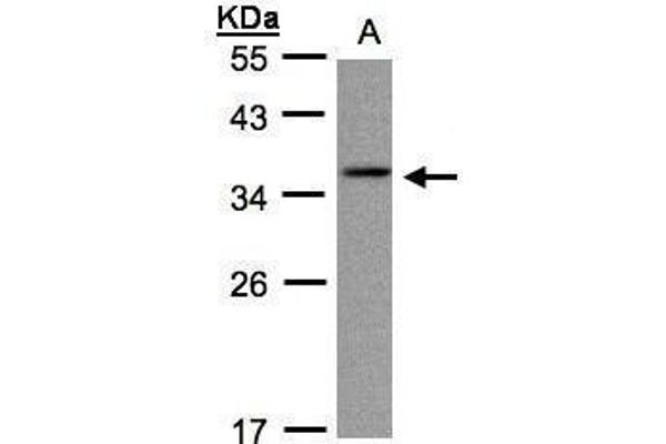 CRYGC antibody