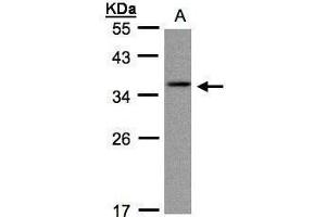 WB Image Sample(30 ug whole cell lysate) A:A431, 12% SDS PAGE antibody diluted at 1:1000 (CRYGC antibody)