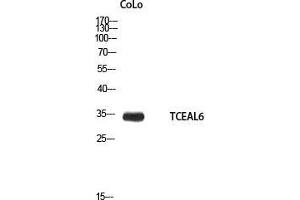 Western Blot (WB) analysis of CoLo using TCEAL6 antibody. (TCEAL6 antibody)