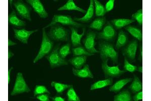 Immunofluorescence analysis of A549 cells using XRCC2 antibody (ABIN5970910). (XRCC2 antibody)