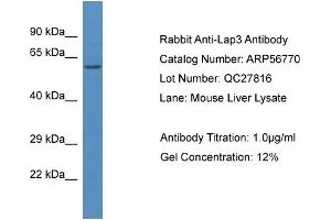 Western Blotting (WB) image for anti-Cytosol Aminopeptidase (LAP3) (N-Term) antibody (ABIN2786892) (LAP3 antibody  (N-Term))