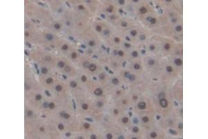 IHC-P analysis of Human Tissue, with DAB staining. (MX2 antibody  (AA 1-300))