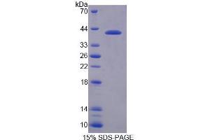 SDS-PAGE analysis of Human NCOR1 Protein. (NCOR1 Protein)