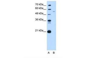 Image no. 1 for anti-Growth Arrest-Specific 7 (GAS7) (C-Term) antibody (ABIN321339) (GAS7 antibody  (C-Term))