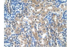 ABP1 antibody was used for immunohistochemistry at a concentration of 4-8 ug/ml to stain Epithelial cells of renal tubule (arrows) in Human Kidney.