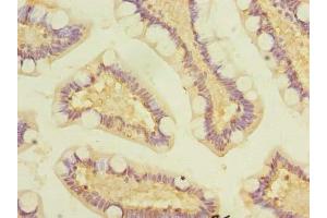 Immunohistochemistry of paraffin-embedded human small intestine tissue using ABIN7163860 at dilution of 1:100 (GALNT12 antibody  (AA 1-272))