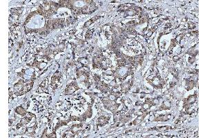 IHC analysis of FEN1 using anti-FEN1 antibody (ABIN7601619).