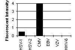 Cross Reactivity Results determined by IFA (Pp28 Tegument Protein (CMV Pp28) antibody)
