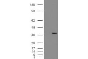 Western Blotting (WB) image for anti-Aldo-Keto Reductase Family 1, Member B1 (Aldose Reductase) (AKR1B1) antibody (ABIN5912019) (AKR1B1 antibody)