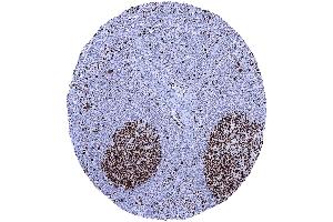 In lymph nodes a particularly strong MCM7 staining occurs in most cells of germinal centres (Recombinant MCM7 antibody  (AA 195-319))