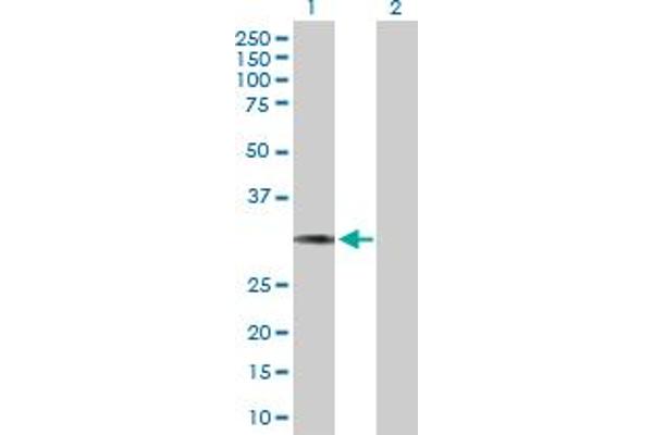 HCCS antibody  (AA 1-268)