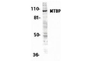 Western Blotting (WB) image for anti-MDM2 Binding Protein (MTBP) (Middle Region 2) antibody (ABIN1031200) (MTBP antibody  (Middle Region 2))